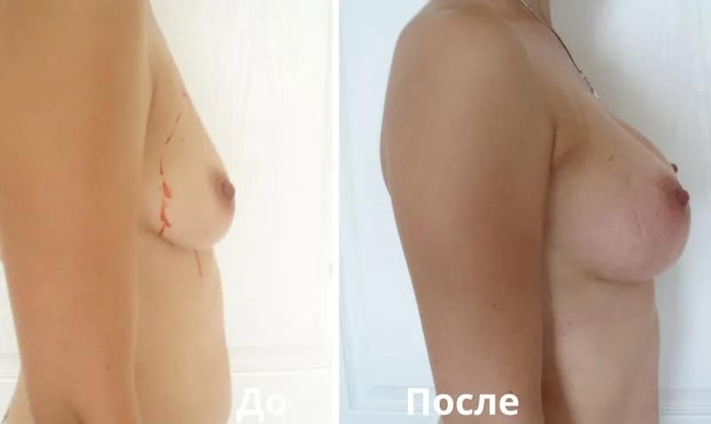 Результат операції приховано до підтвердження віку