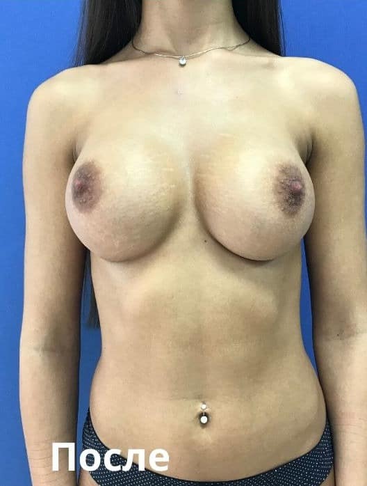 Результат операції приховано до підтвердження віку