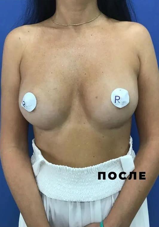 Результат операції приховано до підтвердження віку